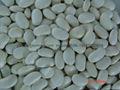 white kidney beans 4