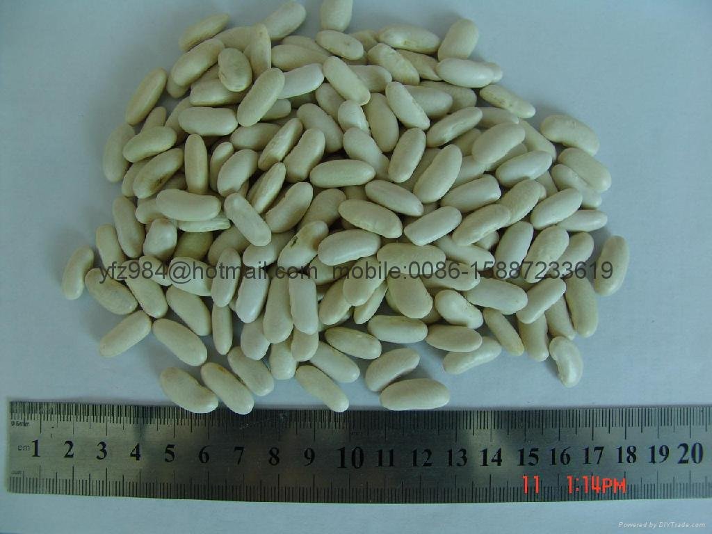Large white kidney beans 3