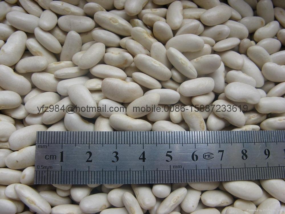 Large white kidney beans 4