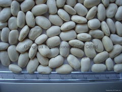 Square (Middle ) white kidney beans 