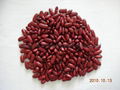 Dark english kidney beans 1