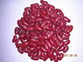 Dark english kidney beans 2