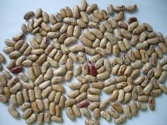 light speckled kideny beans