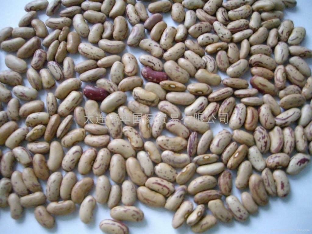 light speckled kideny beans 2