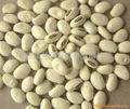 white kidney beans 5