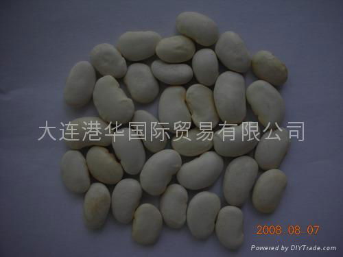 white kidney beans 3