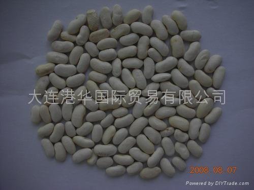 white kidney beans 4