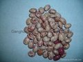 light speckled kidney beans round shape 2