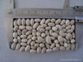 White Kidney Beans Japanese Shape 1