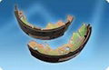 brake shoes