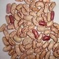 Light speckled kidney beans 1