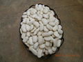 LARGE WHITE KIDNEY BEANS 3