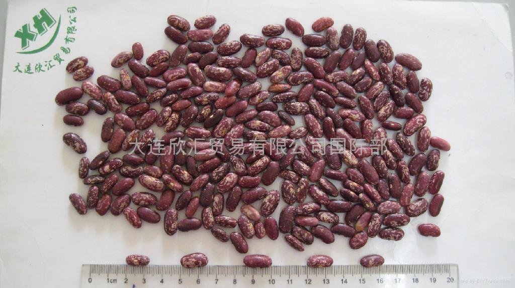 PURPLE SPECKLED KIDNEY BEANS