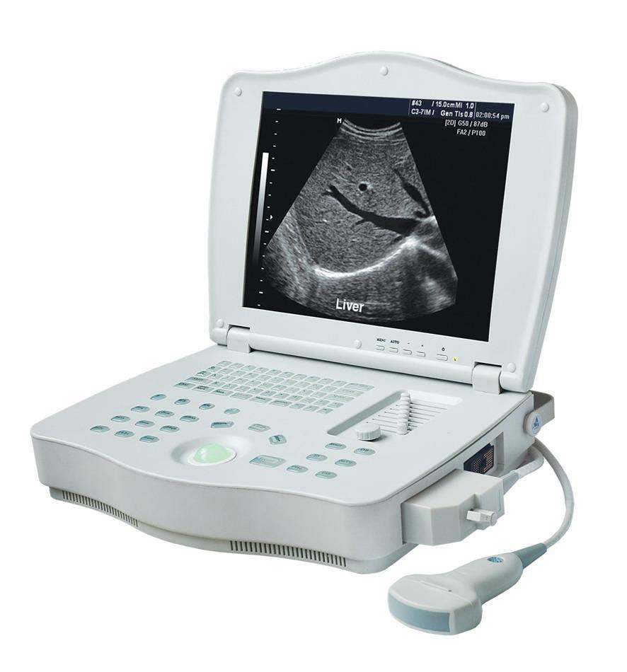 Digital B ultrasound scanner