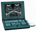 Digital notebook ultrasound scanner