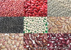 light speckled kidney beans