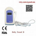 CE approved fetal doppler Ultrasound  1