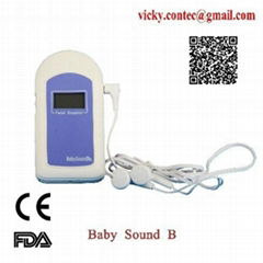 CE approved fetal doppler Ultrasound