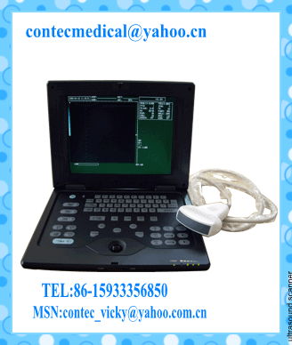  Palmsize Medical Ultrasound scanner 