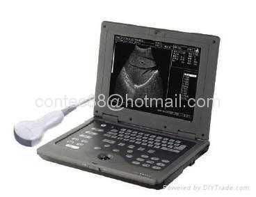  Palmsize Medical Ultrasound scanner  2