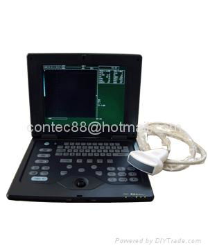  Palmsize Medical Ultrasound scanner  3