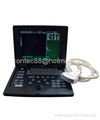  Palmsize Medical Ultrasound scanner  3