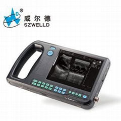 Palm Size Ultrasound Scanner