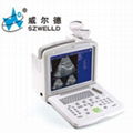 ultrasound scanner