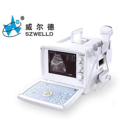 Digital ultrasound scanner