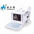 Digital ultrasound scanner 1