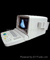 US-100B Portable Convex Ultrasound Scanner