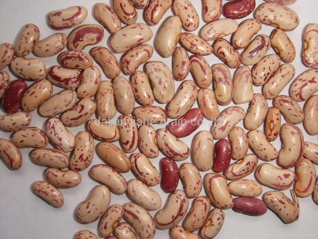 Light Speckled Kidney beans 2
