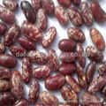 Purple Speckled Kidney beans 1