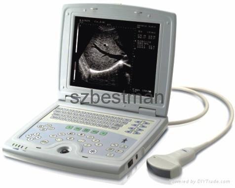  Ultrasound Scanners BEU-8800