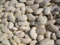 white kidney bean 1