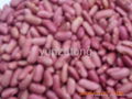 light red kidney bean 1