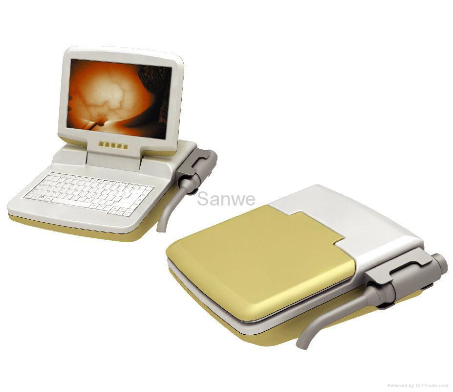 SW-3003 Infrared Inspect Equipment for Mammary Gland (Portable type of new gener