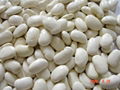 White Kidney Beans with best quality 2011 crop