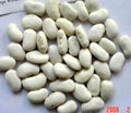 White Kidney Beans with best quality 2011 crop 2