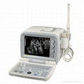 B mode ultrasound scanner KX2000G 1