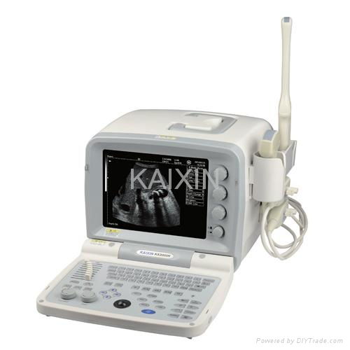 B mode ultrasound scanner KX2000G