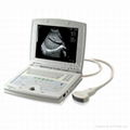 Laptop ultrasound scanner 1