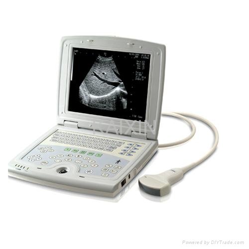 Laptop ultrasound scanner