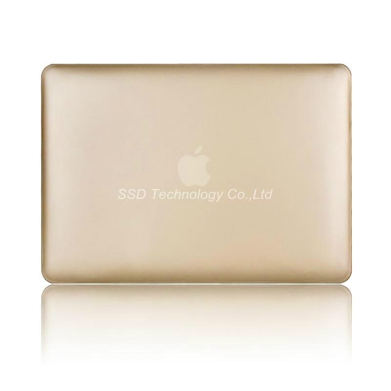 New golden color case for Macbook