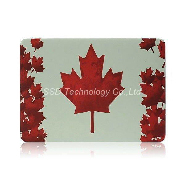 Macbook case 5