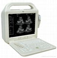 laptop ultrasound scanner machine 1