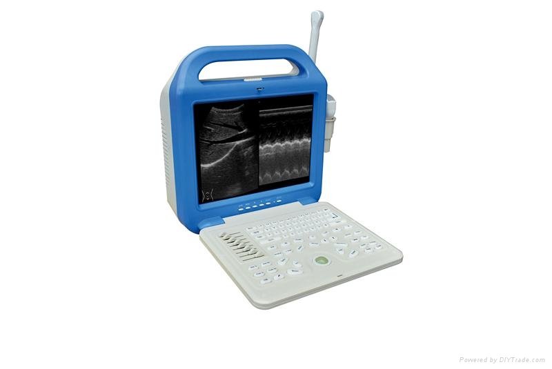 laptop ultrasound scanner machine 2