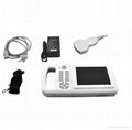 palm ultrasound scanner human use 1