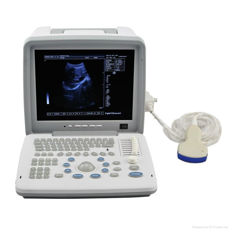 Laptop human ultrasound scanner 2