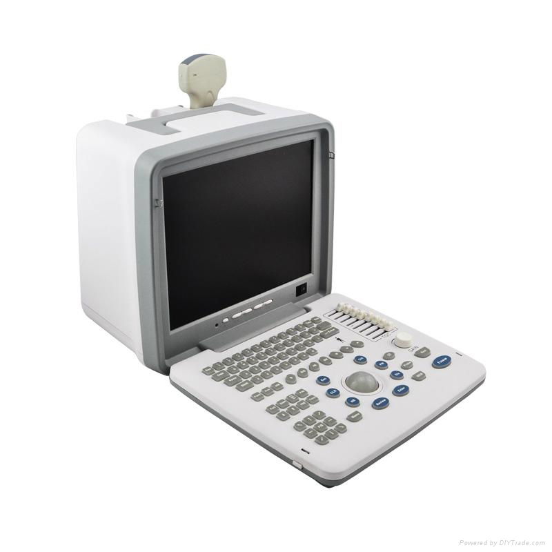 Laptop human ultrasound scanner 3